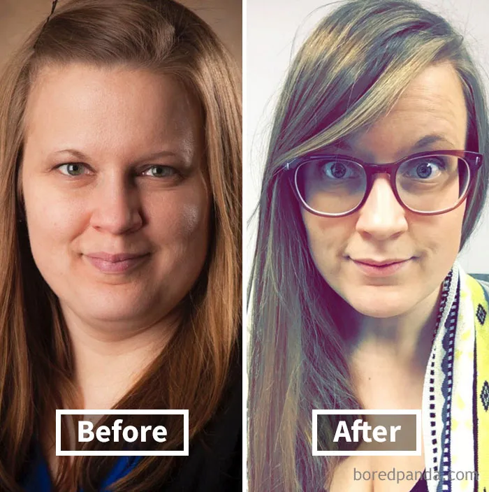 Before and after weight loss showing face fat reduction in a side-by-side comparison.