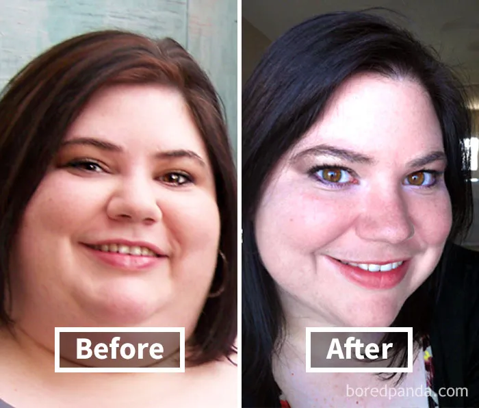 Before and after photos showing face fat loss transformation.