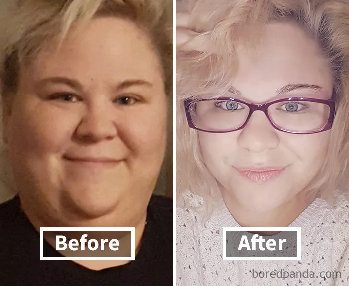 Before and after weight loss face transformation showing noticeable fat reduction.
