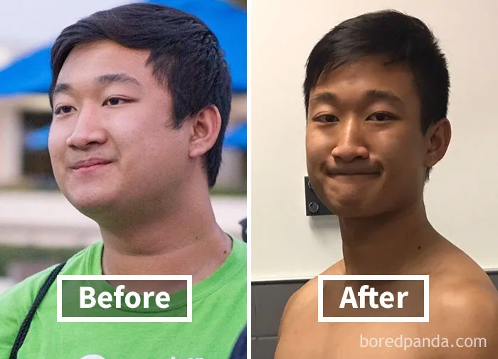 Before and after face fat loss transformation showing noticeable changes post weight loss.