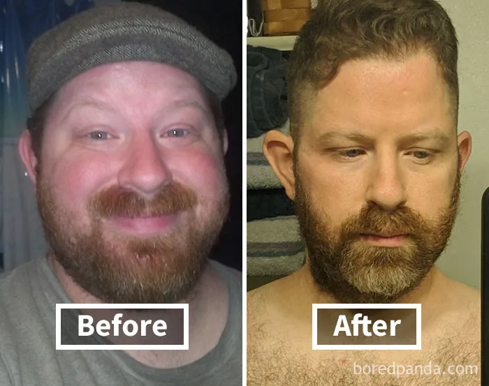 Before and after comparison showing face fat loss from weight loss.