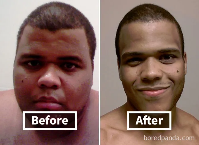 Before and after face fat loss showing significant weight reduction.