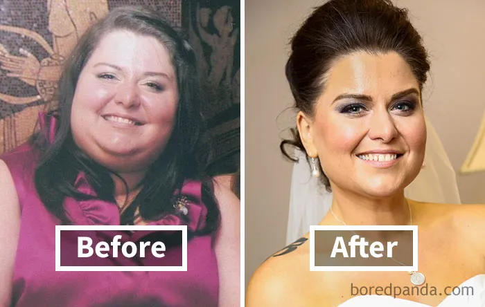 Before and after weight loss face fat reduction transformation with a woman smiling.