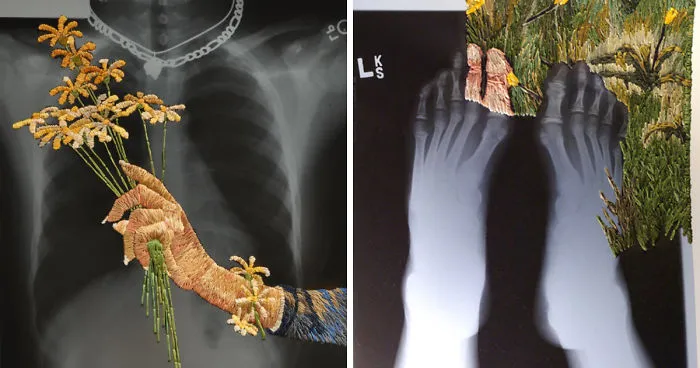 Artist Embroiders X-Rays And It's Beautiful And Creepy At The Same Time