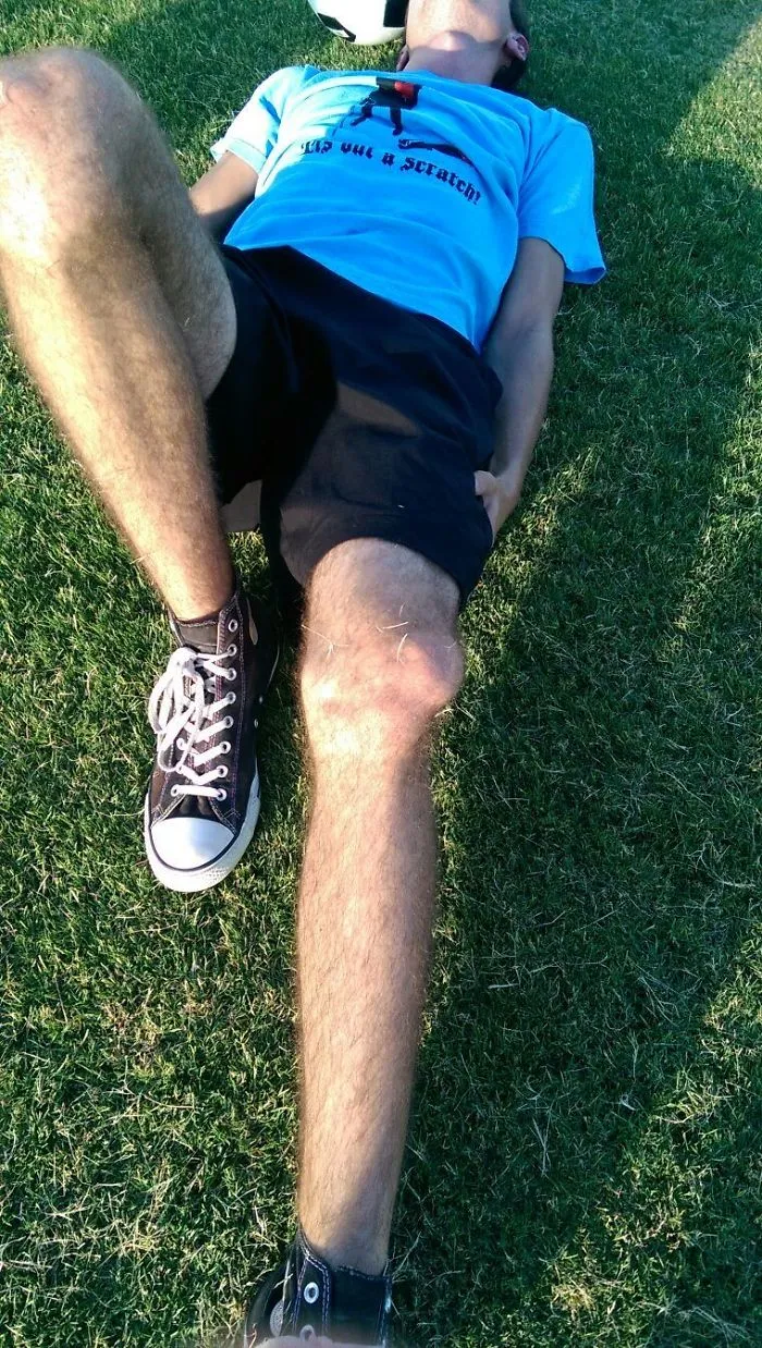 So My Friend Dislocated His Knee The Other Day. Look At The Shirt He Was Wearing When It Happened