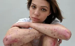People Reveal Their Scars And How They Got Them In A Powerful Photo Project