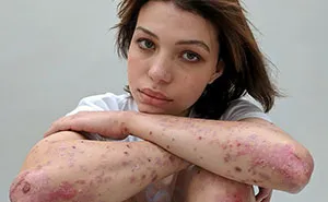 People Reveal Their Scars And How They Got Them In A Powerful Photo Project