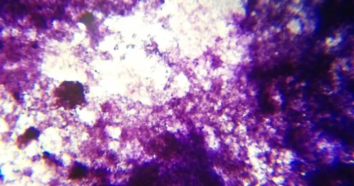 I Find Cosmos Under My Microscope And With Microbial Plate - Microsmos
