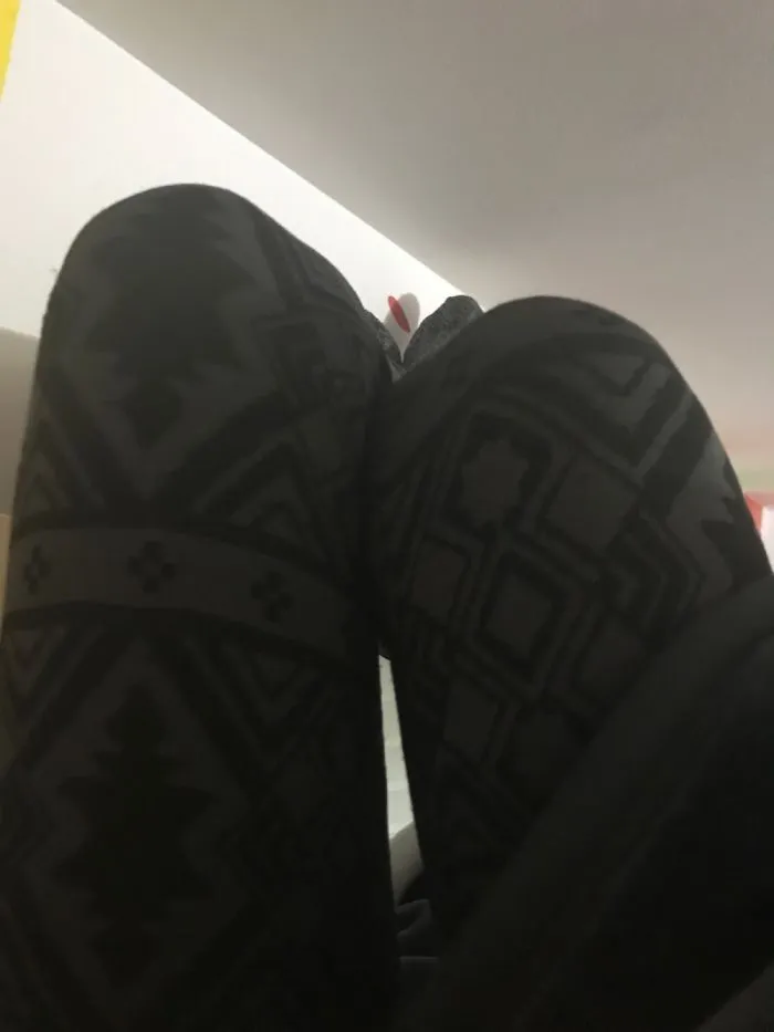 I Collect Knees So Far I Have Two!