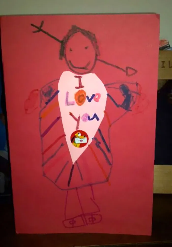 Cupid's Arrow Stuck In A Head Is Definitely Not A Big Deal
