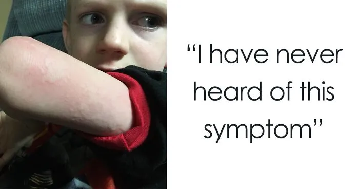 Mom Warns Other Parents About The Unusual Flu Symptom Her Son Experienced