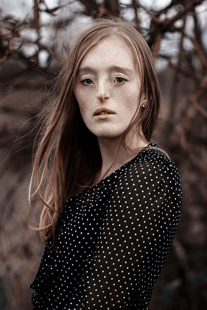 Esta chica de 26 años nacida con un raro defecto facial rompe los estándares de belleza con su carrera de modelo