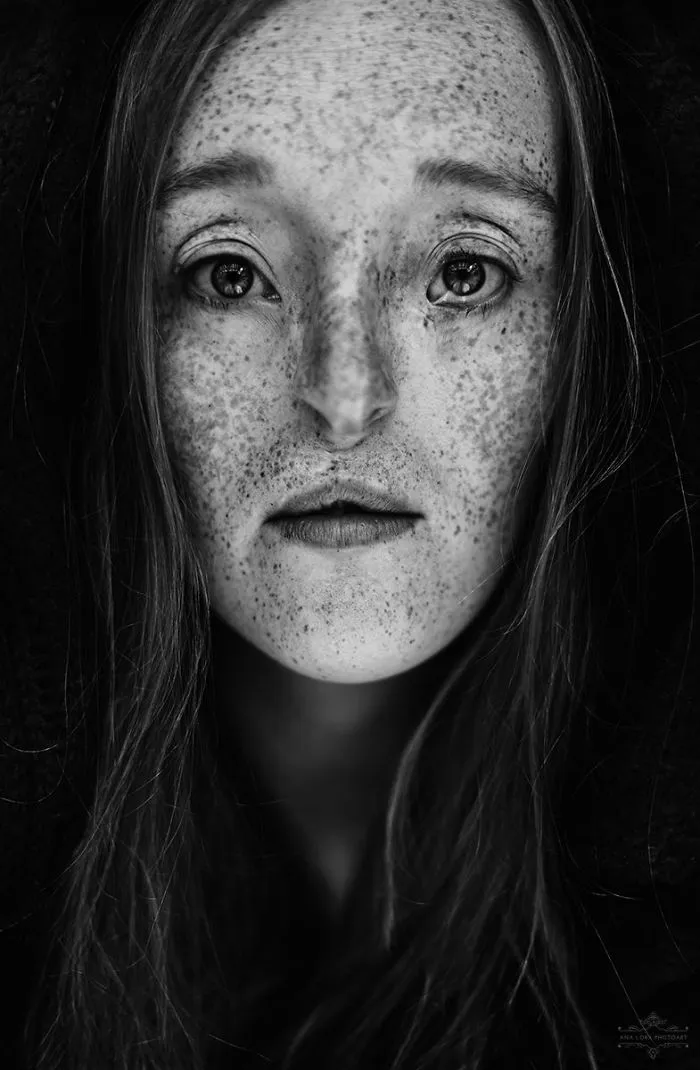 Esta chica de 26 años nacida con un raro defecto facial rompe los estándares de belleza con su carrera de modelo