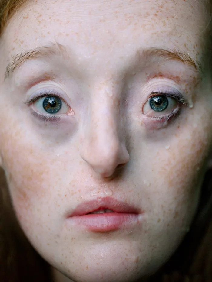 Esta chica de 26 años nacida con un raro defecto facial rompe los estándares de belleza con su carrera de modelo