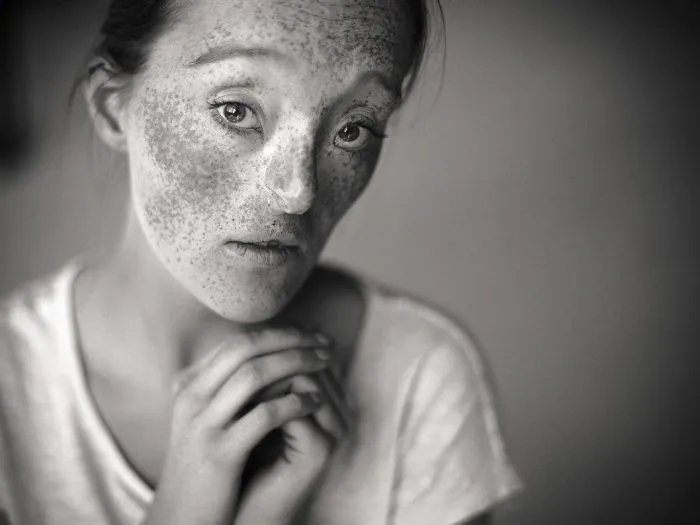 33-Year-Old Born With Extremely Rare Facial Defect Is Breaking Beauty Standards With Her Modeling Career