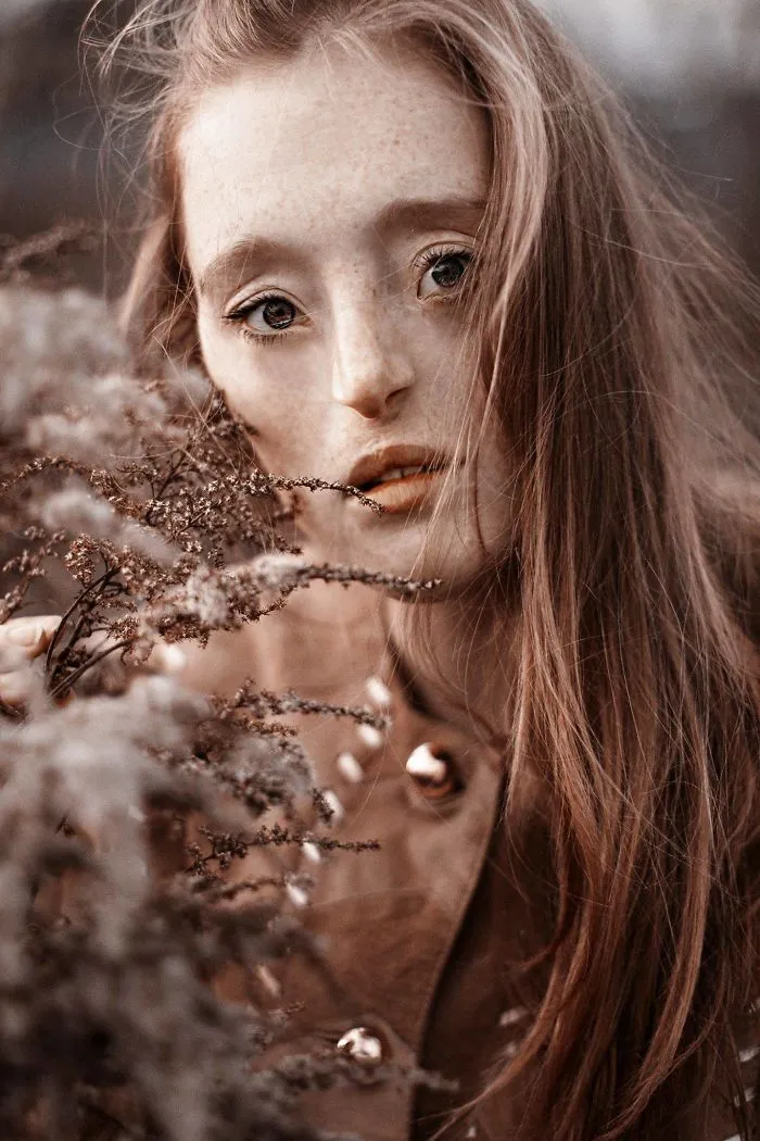 Esta chica de 26 años nacida con un raro defecto facial rompe los estándares de belleza con su carrera de modelo