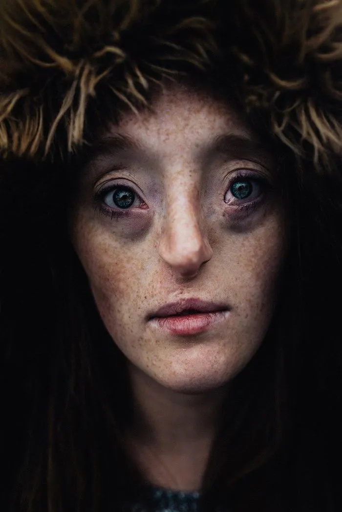 Esta chica de 26 años nacida con un raro defecto facial rompe los estándares de belleza con su carrera de modelo