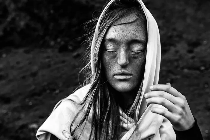 Esta chica de 26 años nacida con un raro defecto facial rompe los estándares de belleza con su carrera de modelo