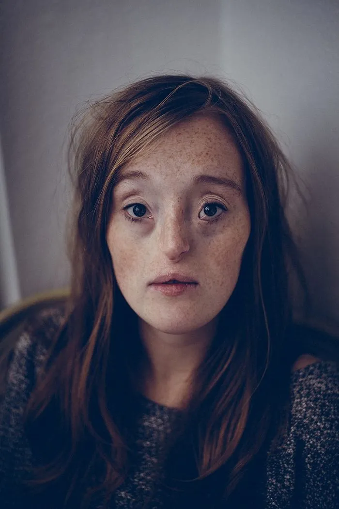 Esta chica de 26 años nacida con un raro defecto facial rompe los estándares de belleza con su carrera de modelo