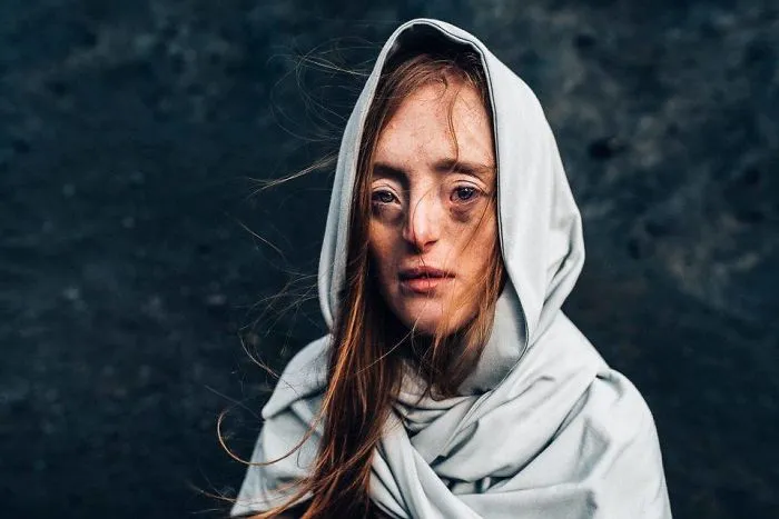 Esta chica de 26 años nacida con un raro defecto facial rompe los estándares de belleza con su carrera de modelo