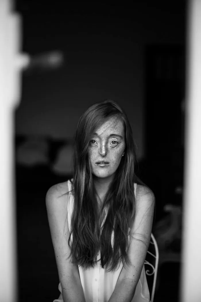 33-Year-Old Born With Extremely Rare Facial Defect Is Breaking Beauty Standards With Her Modeling Career