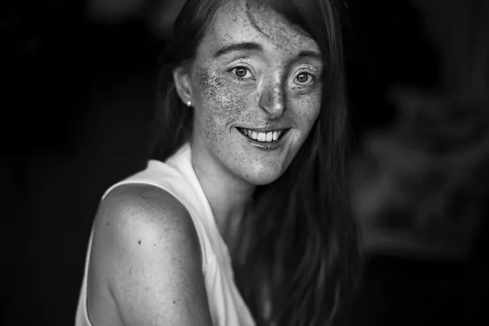 33-Year-Old Born With Extremely Rare Facial Defect Is Breaking Beauty Standards With Her Modeling Career