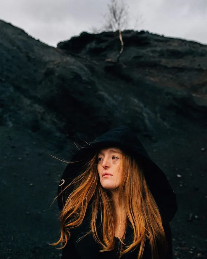 33-Year-Old Born With Extremely Rare Facial Defect Is Breaking Beauty Standards With Her Modeling Career