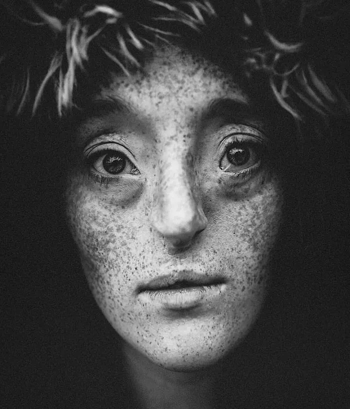 Esta chica de 26 años nacida con un raro defecto facial rompe los estándares de belleza con su carrera de modelo