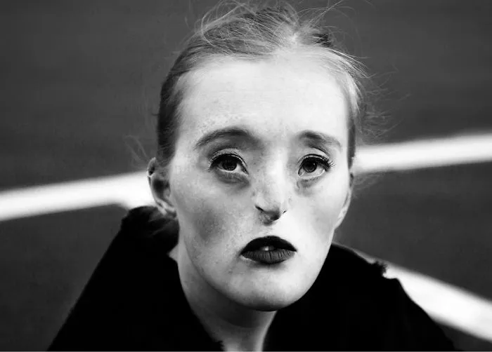 Esta chica de 26 años nacida con un raro defecto facial rompe los estándares de belleza con su carrera de modelo