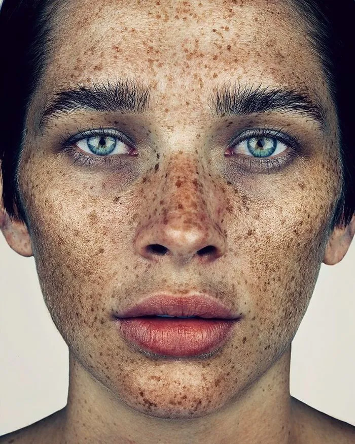 Photographer Takes Portraits Of Freckled People To Celebrate Their Unique Beauty