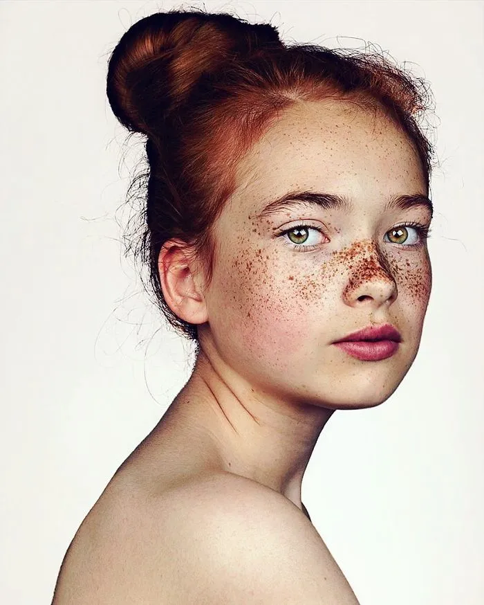 Photographer Takes Portraits Of Freckled People To Celebrate Their Unique Beauty