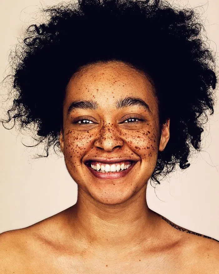 Photographer Takes Portraits Of Freckled People To Celebrate Their Unique Beauty