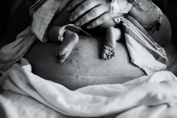 1º puesto en Postparto. Veronika Richardson, de Green Bay, EEUU. "Parto vaginal tras cesárea"