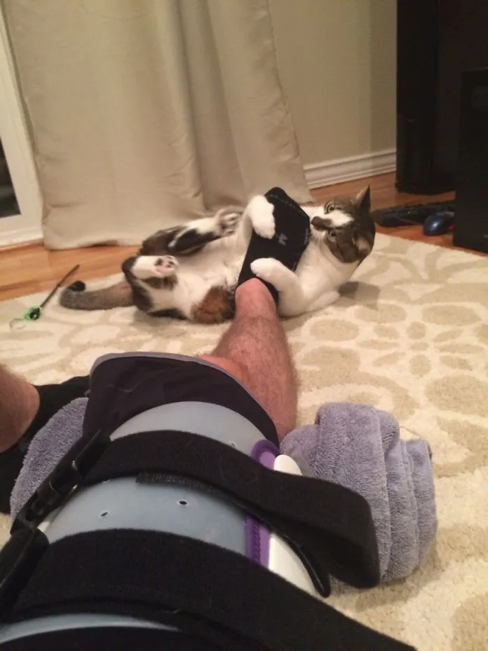 Me acaban de operar y tengo que hacer rehabilitación