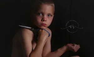 I'm Aghust, Not Neurofibromatosis