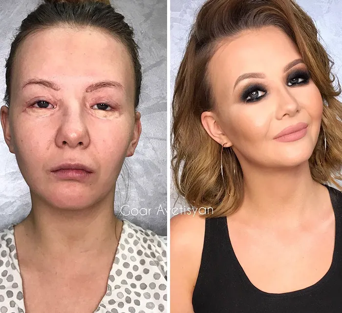 Vlada ha sido operada 15 veces de los ojos y soñaba con una transformación así