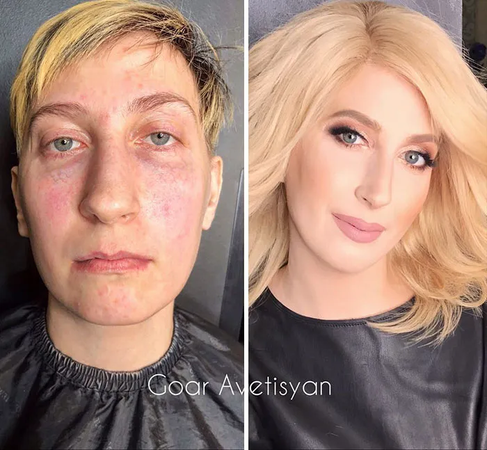 Jekaterina tiene un cáncer agresivo, pero no planea rendirse. Goar la transformó para ayudarle a tener más positividad