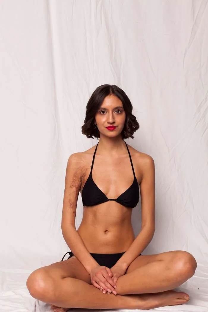 I Started This Campaign To Encourage People Love Themselves With All Their Differences