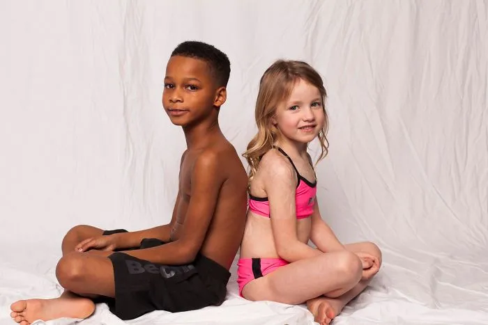 I Started This Campaign To Encourage People Love Themselves With All Their Differences