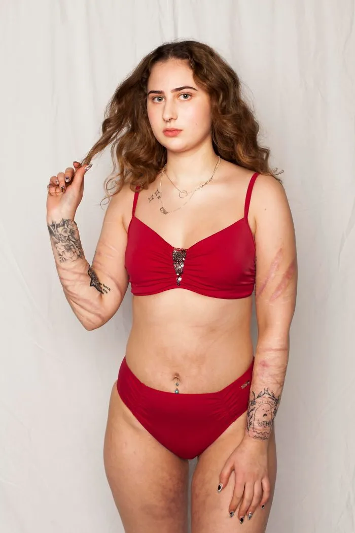 I Started This Campaign To Encourage People Love Themselves With All Their Differences