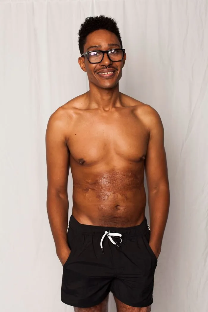 I Started This Campaign To Encourage People Love Themselves With All Their Differences