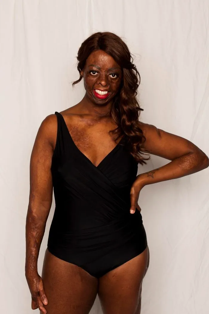 I Started This Campaign To Encourage People Love Themselves With All Their Differences