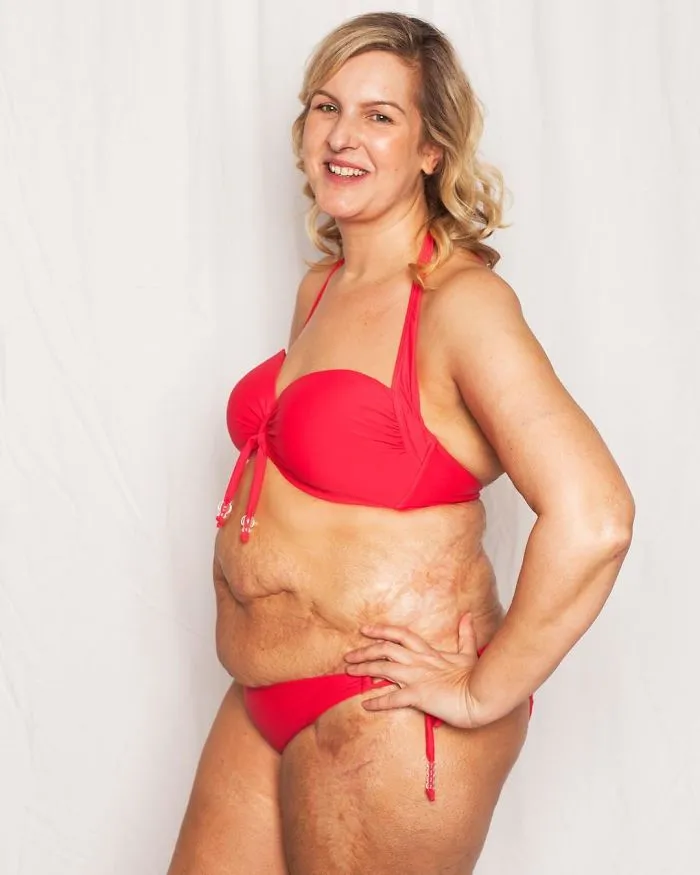 I Started This Campaign To Encourage People Love Themselves With All Their Differences