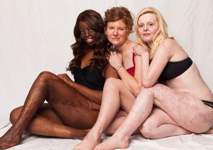 Love Disfigure Swimwear Photo Campaign