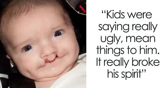 Bullied 7 Year-Old Finds Cat With Same Rare Eye Condition And Cleft Lip, And It's Like Destiny Exists