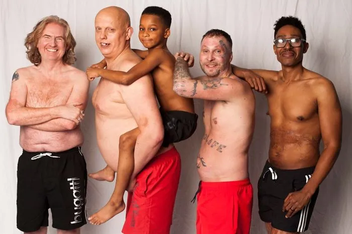 I Started This Campaign To Encourage People Love Themselves With All Their Differences