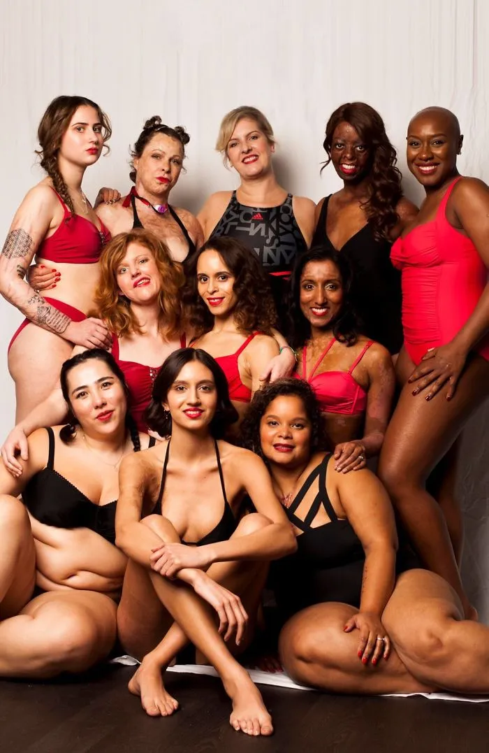 I Started This Campaign To Encourage People Love Themselves With All Their Differences