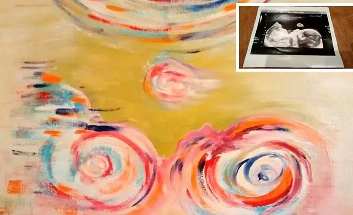 This Artist Transforms Black-And-White Sonograms Into Colorful Paintings