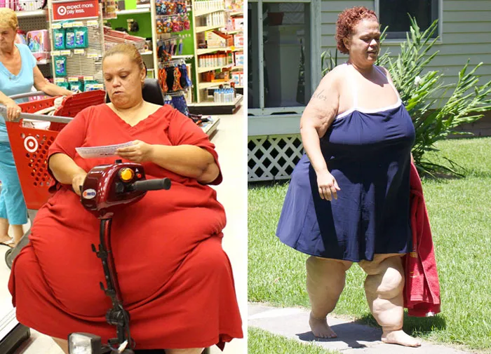 Tara Was 606 Lbs, She Dropped To 278 Lbs