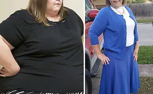 25 Unbelievable Before & After Transformation Pics From ‘My 600 Lb Life’